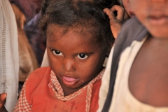 Some of the children we saw on this journey among the Bisharin nomads had a lost look on their faces. Unfortunately I believe this could have been caused by marrying within the families.